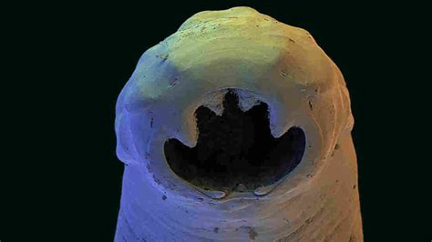  Giant Stomach Worm: A Parasite That Thrives in Unexpected Places!