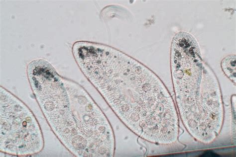  Yellowamoeba - En fascinerande encellig organismis historia från den mikroskopiska världen till våra laboratorier!