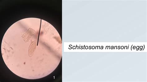  Yukiguni Parasitic Trematode: A Microscopic Marvel That Hijacks Its Hosts with Exquisite Precision!